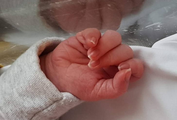 Illustration de l'article : Ces 15 personnes nées avec des signes distinctifs