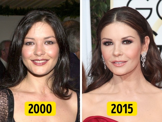 Illustration de l'article : 16 changements physiques de stars en 20 ans !