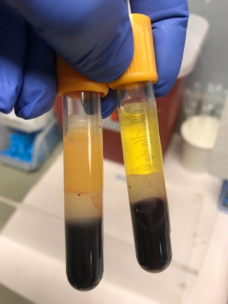 Illustration de l'article : Ces 15 photos qui en disent beaucoup sur le corps humain