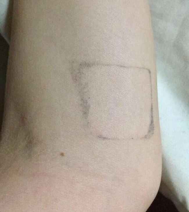 Illustration de l'article : Ces 23 personnes qui n'ont pas vraiment eu de chance