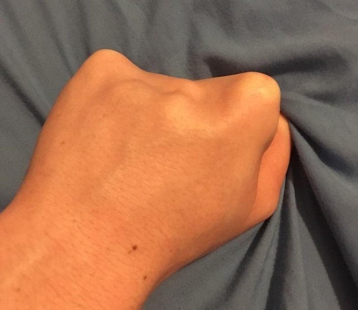 Illustration de l'article : Ces 15 personnes qui ont quelque chose d'unique