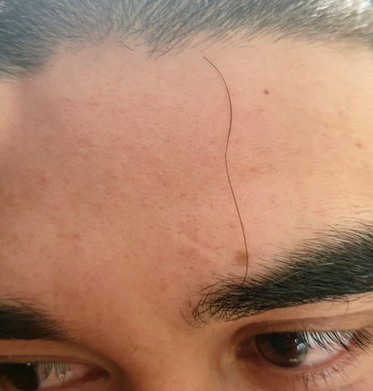 Illustration de l'article : Ces 20 personnes nées avec des particularités offertes par la nature