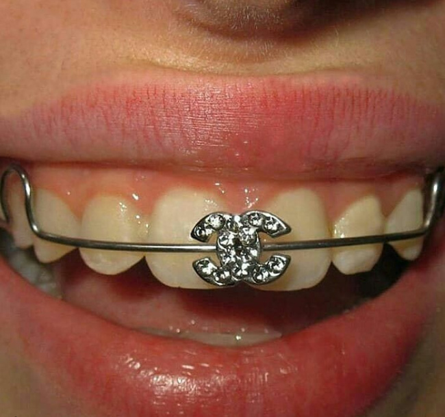 Illustration de l'article : Ces 23 tendances de mode uniques en leur genre