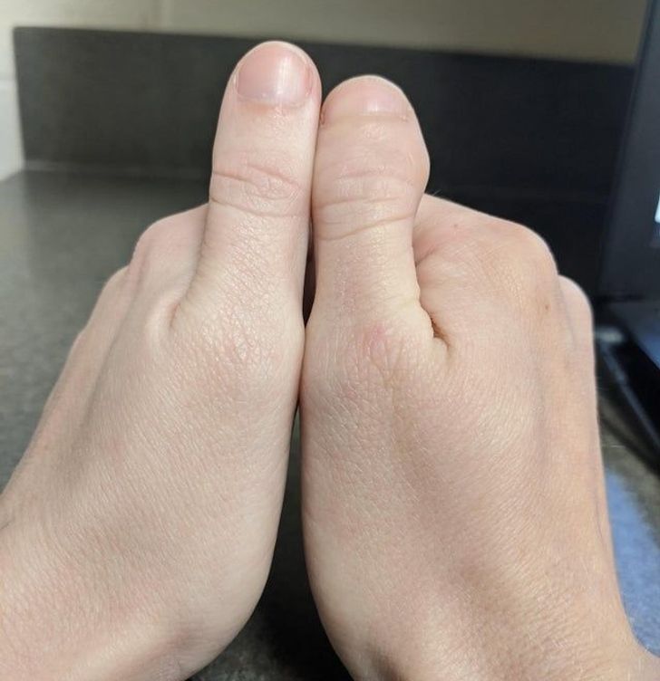 Illustration de l'article : Ces 20 personnes nées avec des particularités offertes par la nature