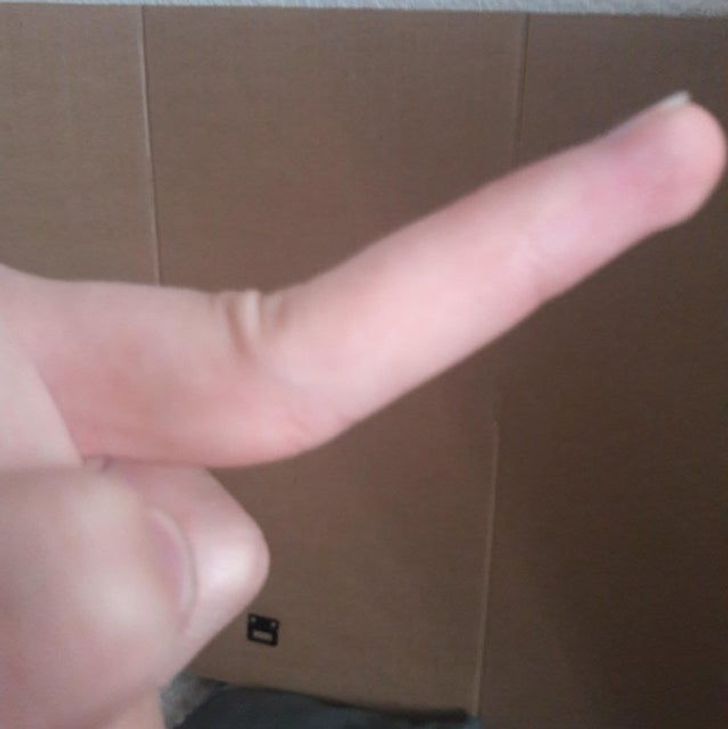 Illustration de l'article : Ces 20 personnes nées avec des particularités offertes par la nature