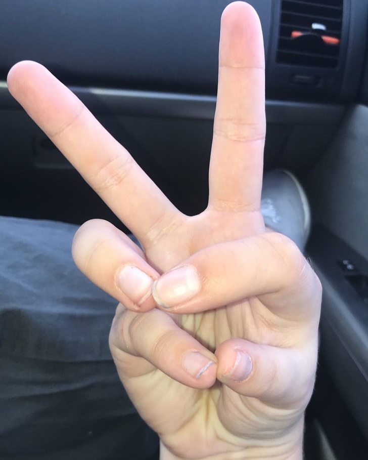 Illustration de l'article : Ces 17 particularités physiques de ces personnes à découvrir