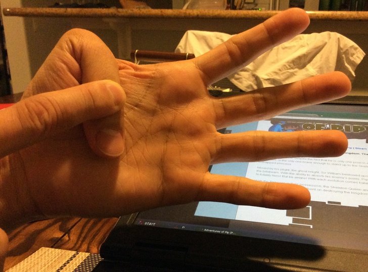 Illustration de l'article : Ces 18 personnes sont uniques grâce à leurs particularités physiques