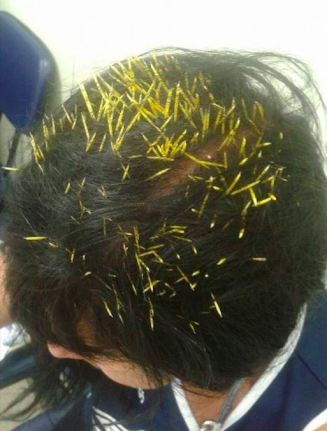 Illustration de l'article : Il y a toujours plus malchanceux que vous, ces 26 personnes le prouvent