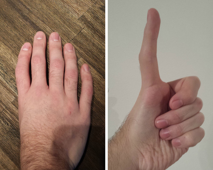 Illustration de l'article : Ces 18 personnes sont uniques grâce à leurs particularités physiques