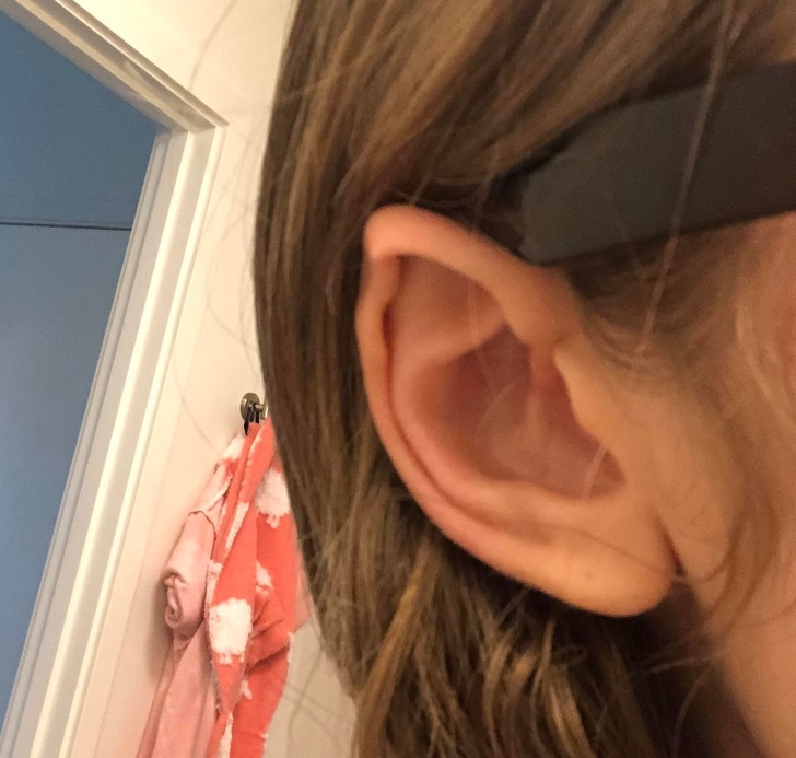 Illustration de l'article : Ces 15 personnes qui ont quelque chose d'unique