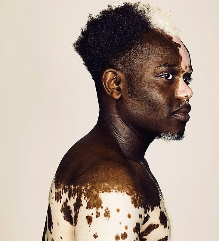 Illustration de l'article : Ces 17 particularités physiques de ces personnes à découvrir