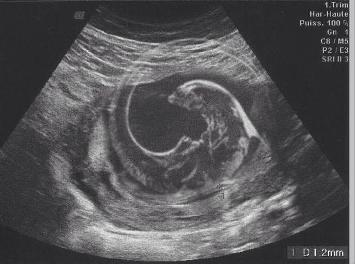 Illustration de l'article : Ces 15 photos de couples qui mettent l'humour au cœur de leur relation