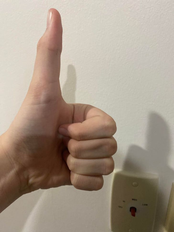 Illustration de l'article : Ces 17 personnes qui ont des traits physiques uniques