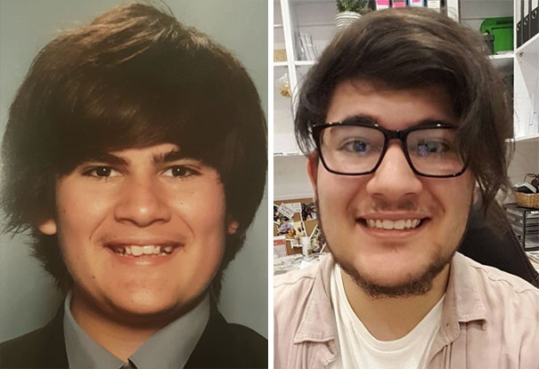 Illustration de l'article : 115 photos avant/après qui prouvent l’efficacité des appareils dentaires 