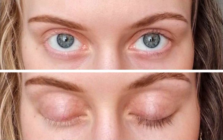 Illustration de l'article : Ces 20 personnes qui ont des traits physiques qui les rendent uniques