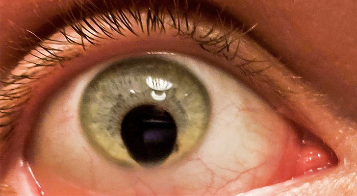 Illustration de l'article : Ces 15 personnes qui ont quelque chose d'unique