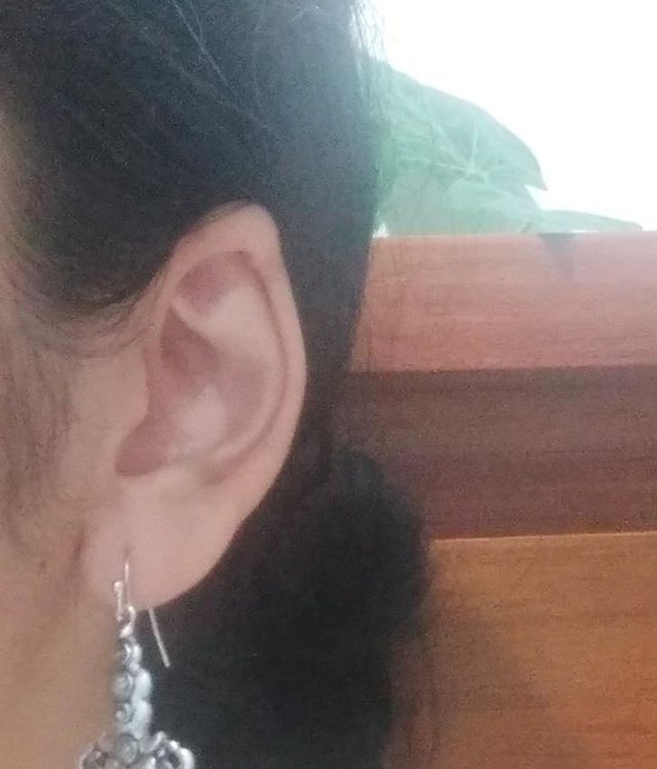 Illustration de l'article : Ces 17 personnes qui ont des traits physiques uniques