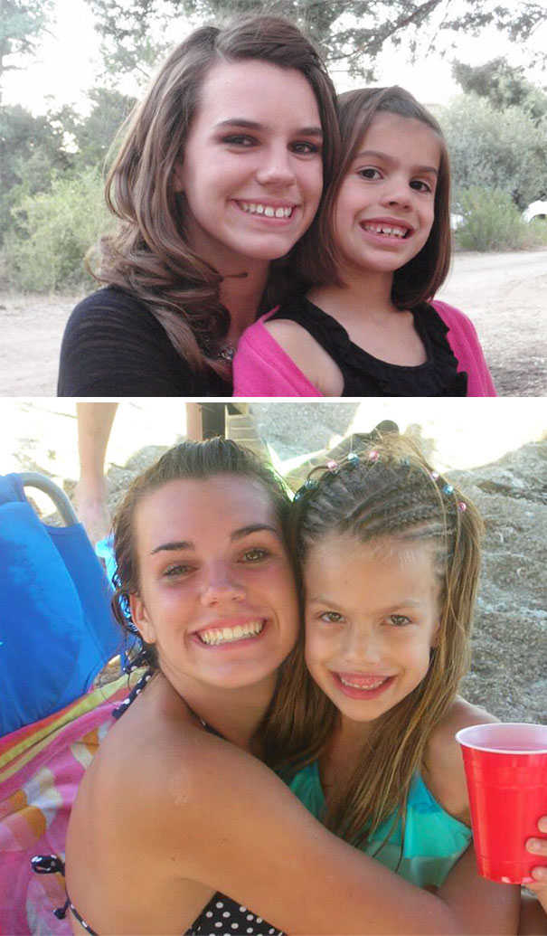 Illustration de l'article : 115 photos avant/après qui prouvent l’efficacité des appareils dentaires 