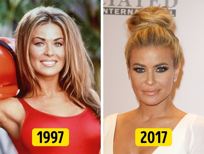 Illustration de l'article : 16 changements physiques de stars en 20 ans !
