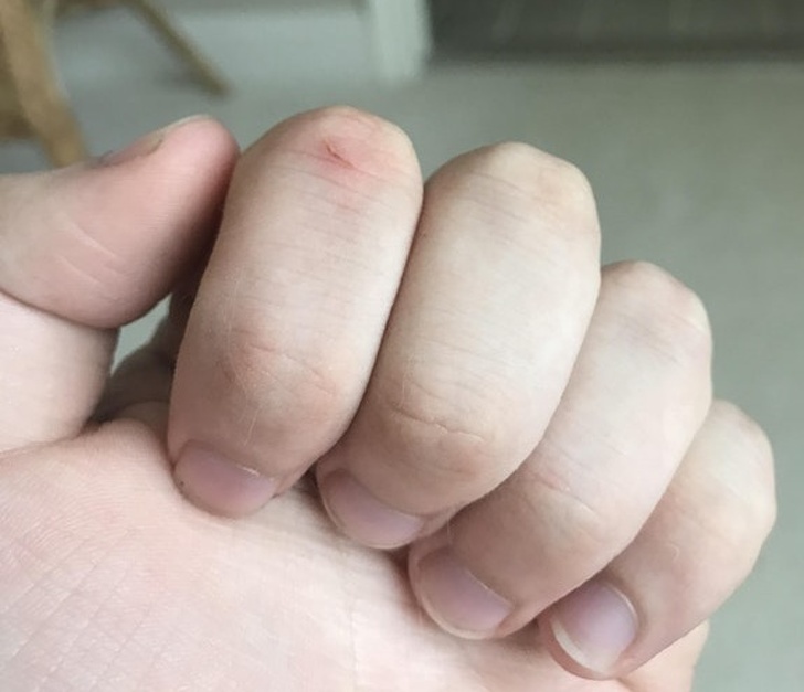 Illustration de l'article : Ces 15 situations qui peuvent rendre fou