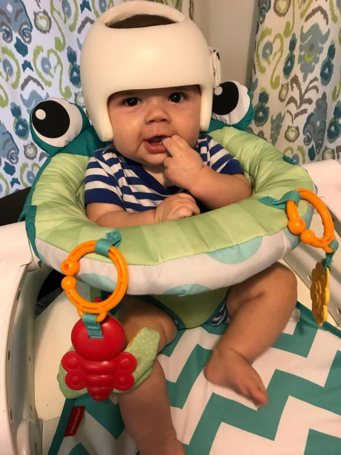 Toute La Famille Porte En Permanence Un Casque De Velo Sur La Tete Pour Soutenir Le Bebe Atteint D Une Maladie