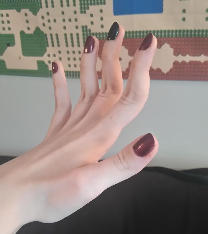 Illustration de l'article : Ces 17 personnes qui ont des traits physiques uniques