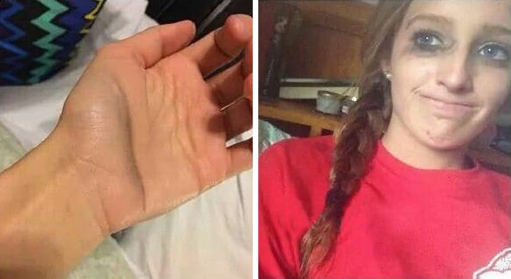 Illustration de l'article : Ces 19 problèmes rencontrés principalement par les filles