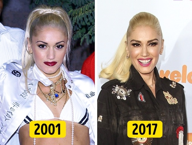 Illustration de l'article : 16 changements physiques de stars en 20 ans !