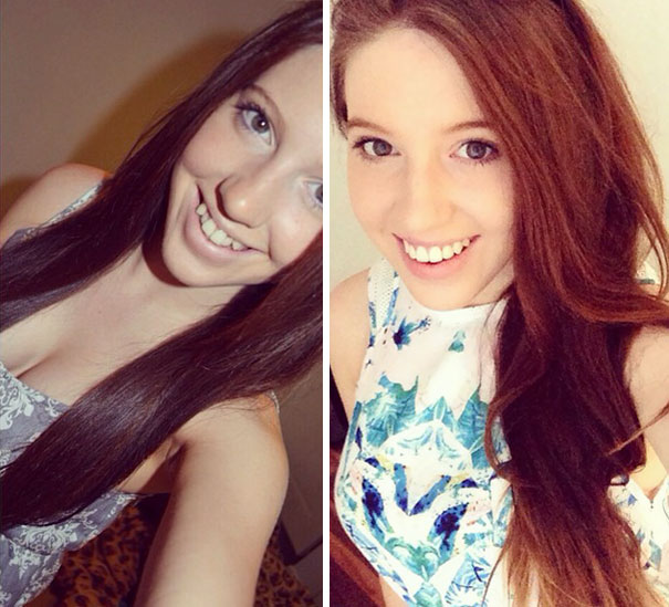 Illustration de l'article : 115 photos avant/après qui prouvent l’efficacité des appareils dentaires 