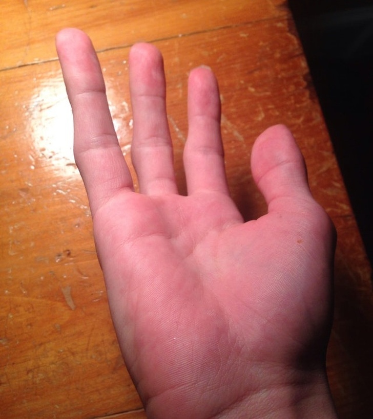 Illustration de l'article : Ces 17 particularités physiques de ces personnes à découvrir