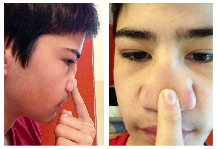 Illustration de l'article : Ces 20 personnes nées avec des particularités offertes par la nature