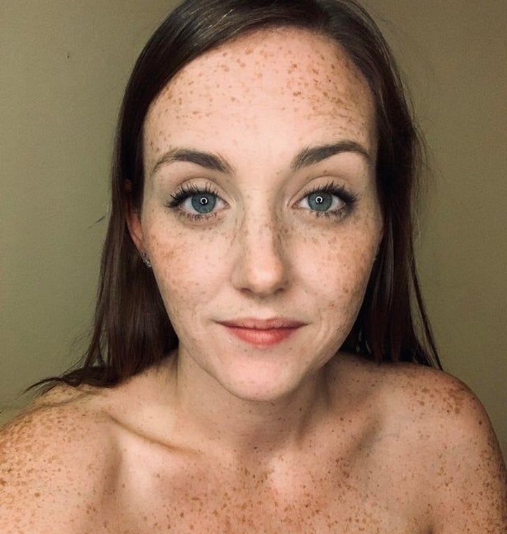 Illustration de l'article : Ces 20 personnes nées avec des particularités offertes par la nature