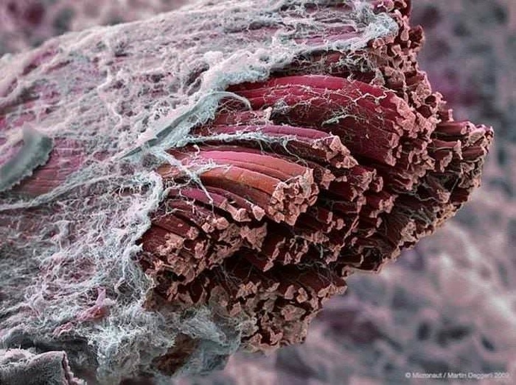 Ces Photos De Choses Prises Au Microscope