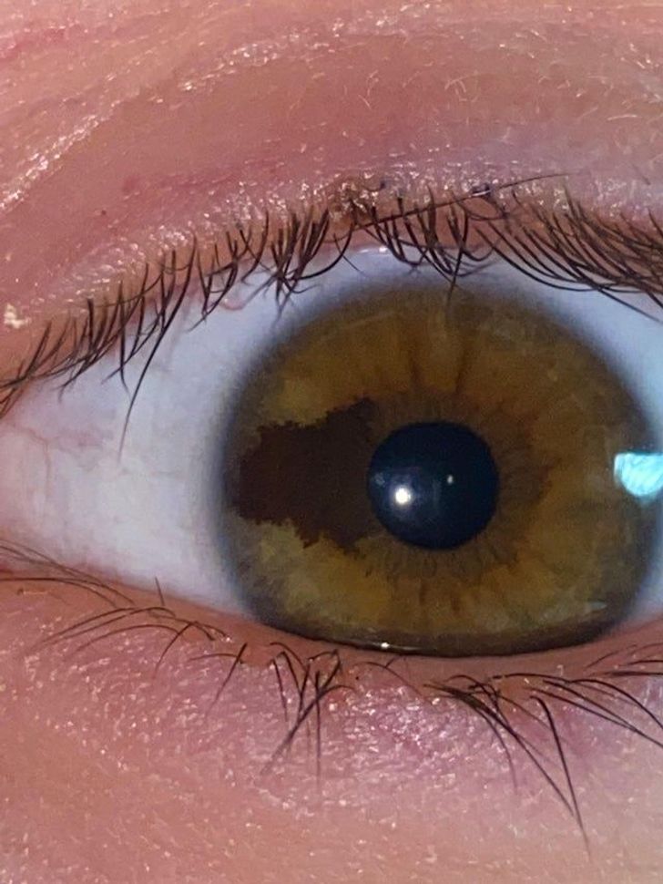 Illustration de l'article : Ces 20 personnes qui ont des traits physiques qui les rendent uniques