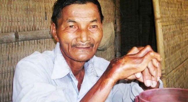 Illustration de l'article : 10 personnes dotées de pouvoirs incroyables dignes des super héros