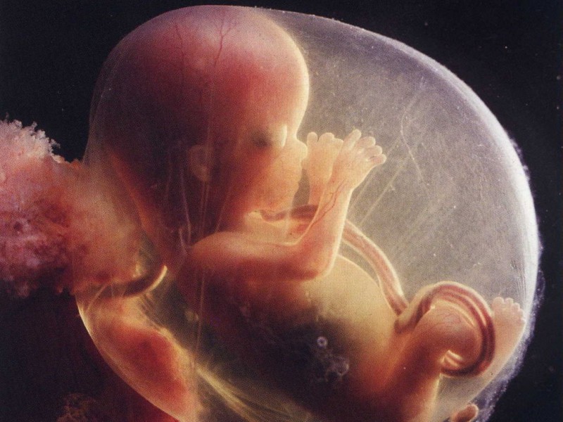 Illustration de l'article : Ces 12 choses méconnues à savoir sur les rêves