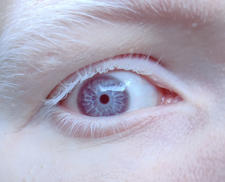 Illustration de l'article : Ces 20 personnes nées avec des particularités offertes par la nature