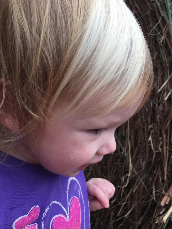 Illustration de l'article : Ces 15 personnes qui ont quelque chose d'unique