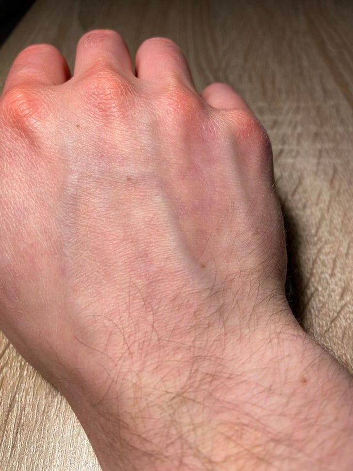 Illustration de l'article : Ces 20 personnes qui ont des traits physiques qui les rendent uniques